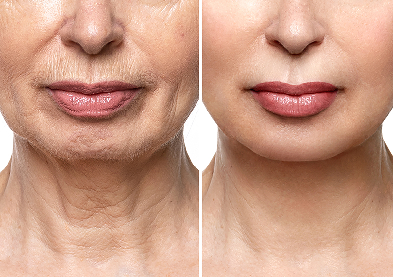 Rejuventu Aesthetics